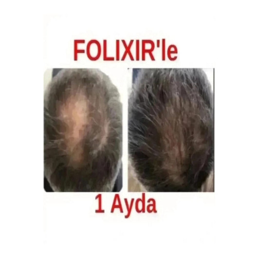 Anti Hair Loss Serum 60 Ml