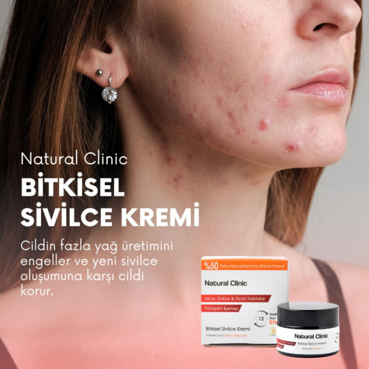 Natural Clinic Herbal Acne Cream 30 Ml