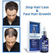 Blue Hair Care Anti-Hair Loss Serum Natural Herbs